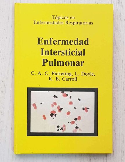 ENFERMEDAD INTERSTICIAL PULMONAR