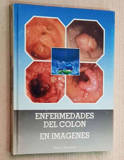 ENFERMEDADES DEL COLON EN IMÁGENES